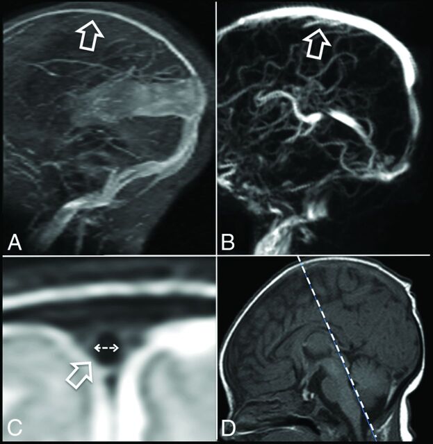 Fig 1.