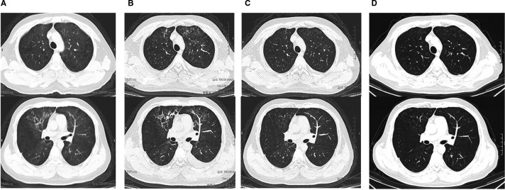 FIGURE 2