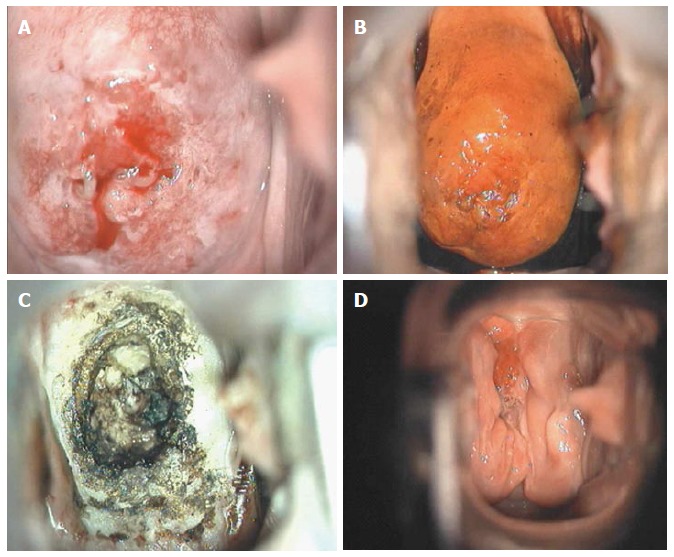 Figure 17