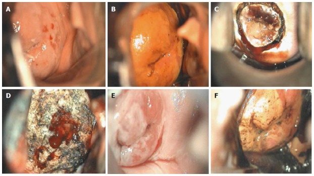 Figure 13