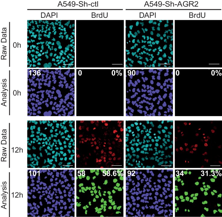 Figure 2—figure supplement 1.