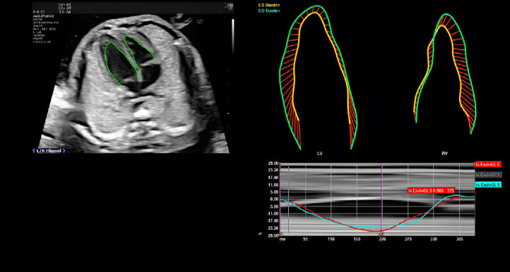 Fig. 12.