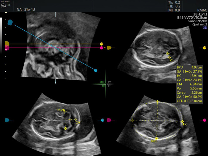 Fig. 20.