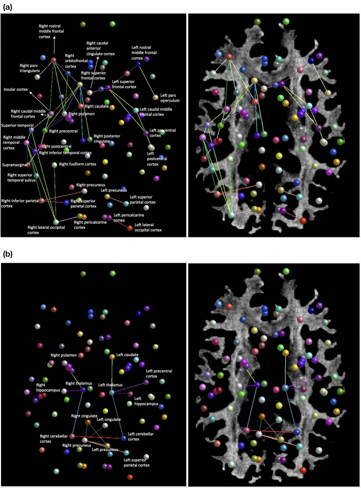 Case Report: An Mri Traumatic Brain Injury Longitudinal Case Study At 7 