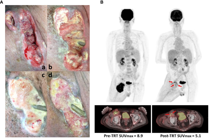 Figure 2