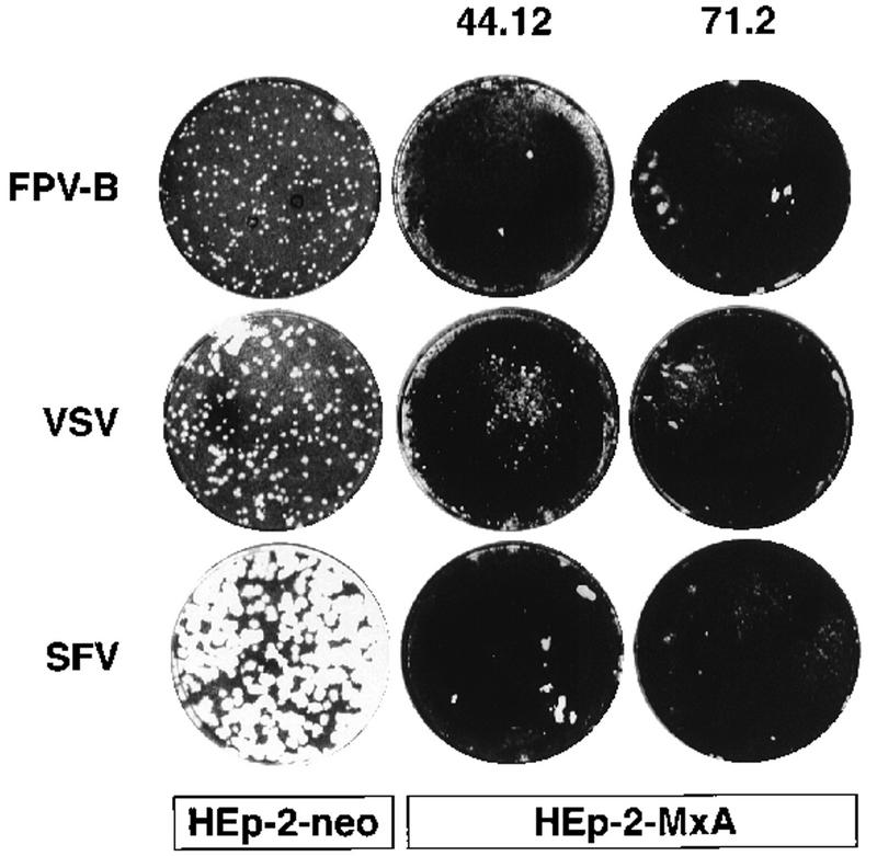 FIG. 1