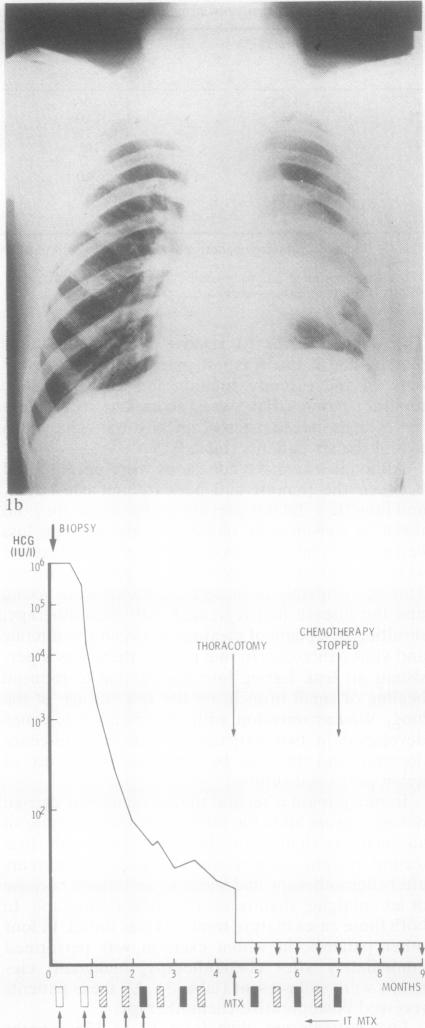 graphic file with name thorax00216-0020-a.jpg