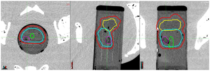 Fig. 26