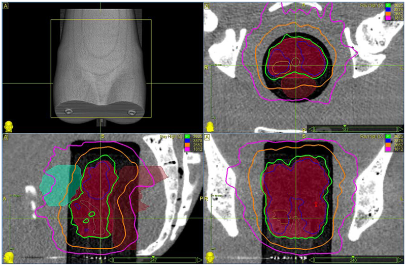 Fig 28