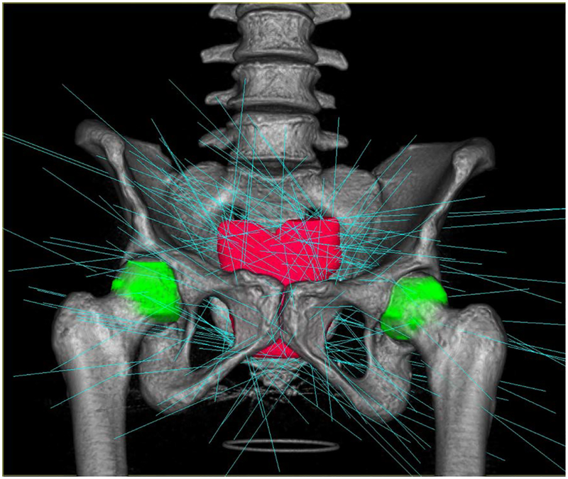 Fig. 29.