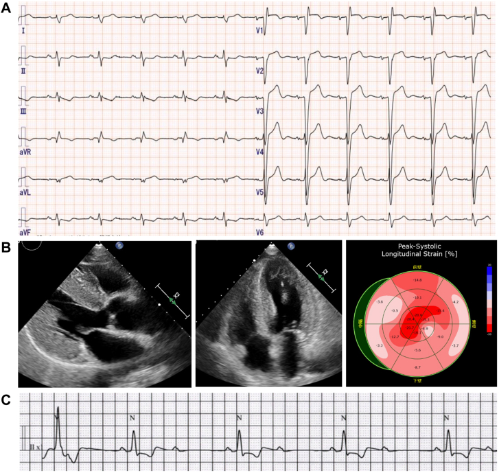 Figure 1