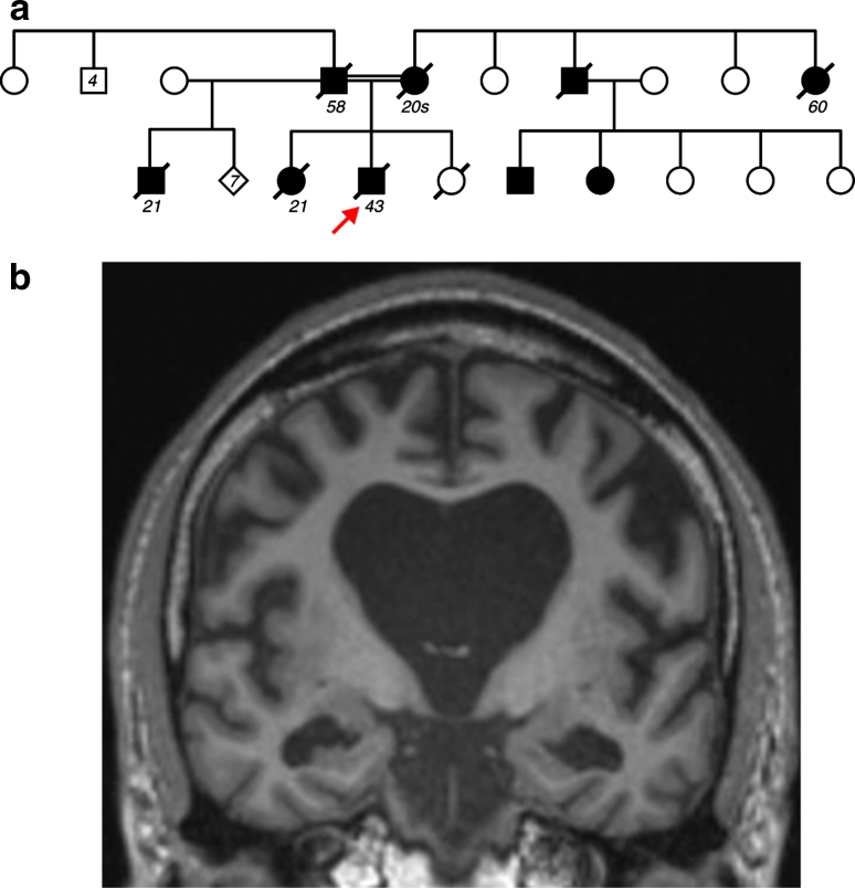 Fig. 1