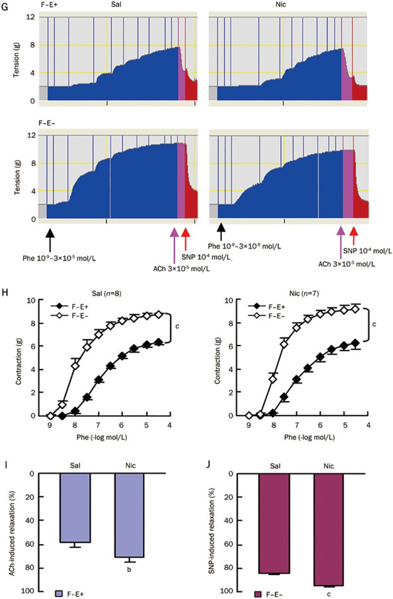 Figure 2G-2J