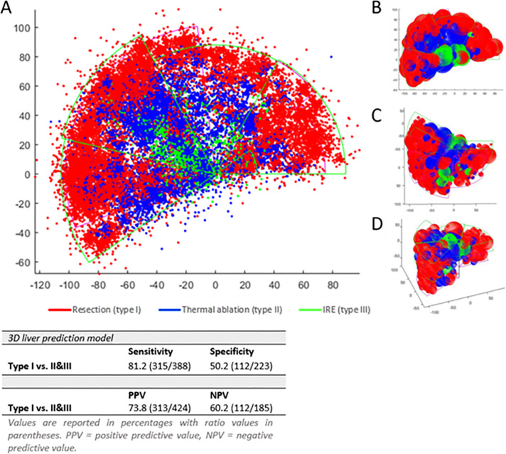 (A) Three-dimensional (3D) liver treatment prediction model for small colorectal liver metastases (red: prefer resection; blue: prefer thermal ablation; green: prefer nonthermal ablation). (B) Top, (C) bottom, and (D) frontal views of the model. IRE = irreversible electroporation.