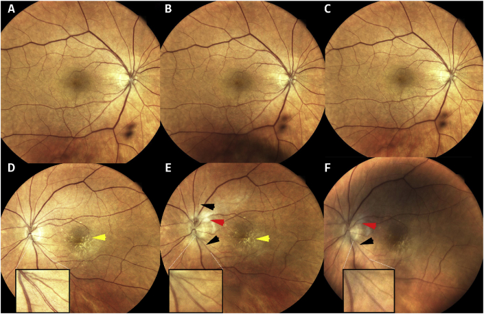 Fig. 1