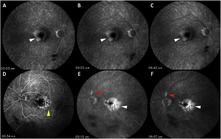 Fig. 3