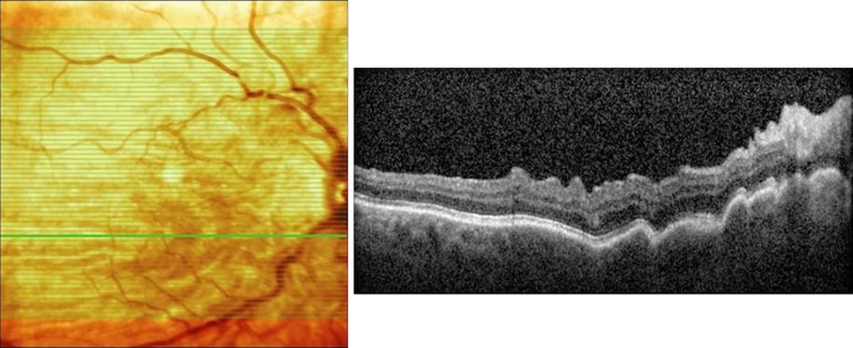 Fig. 2