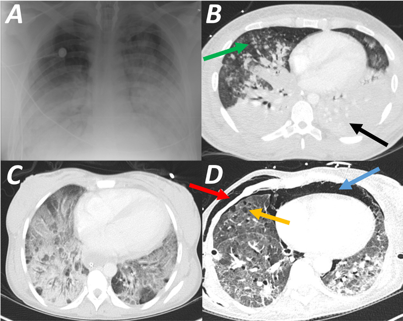 Figure 1: