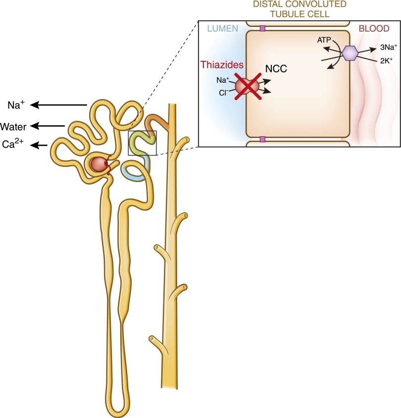 Figure 11.