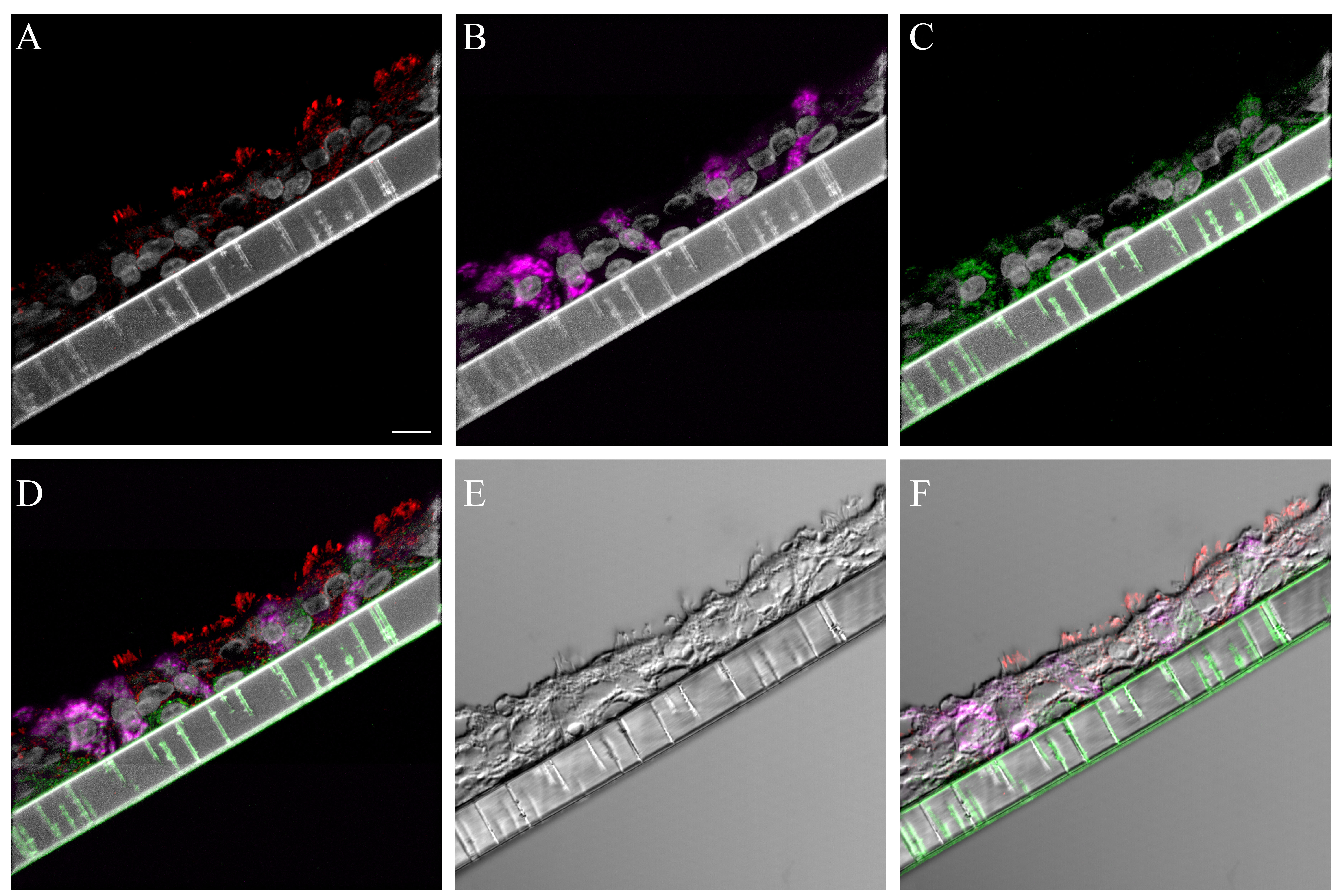 graphic file with name S2_PBS_B_NHBE_cell_markers.jpg