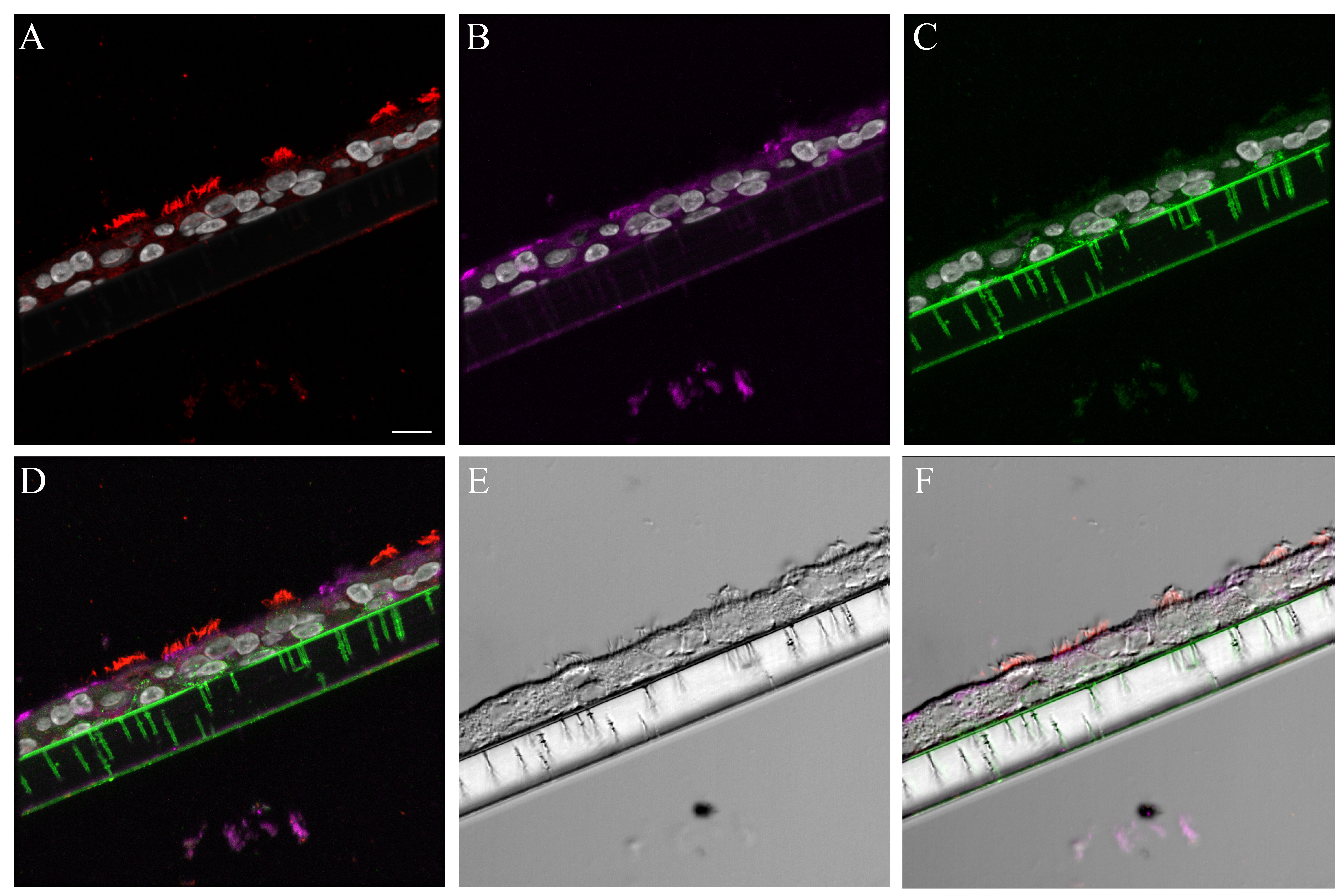 graphic file with name S3_PBS_A_NHBE_cell_markers.jpg