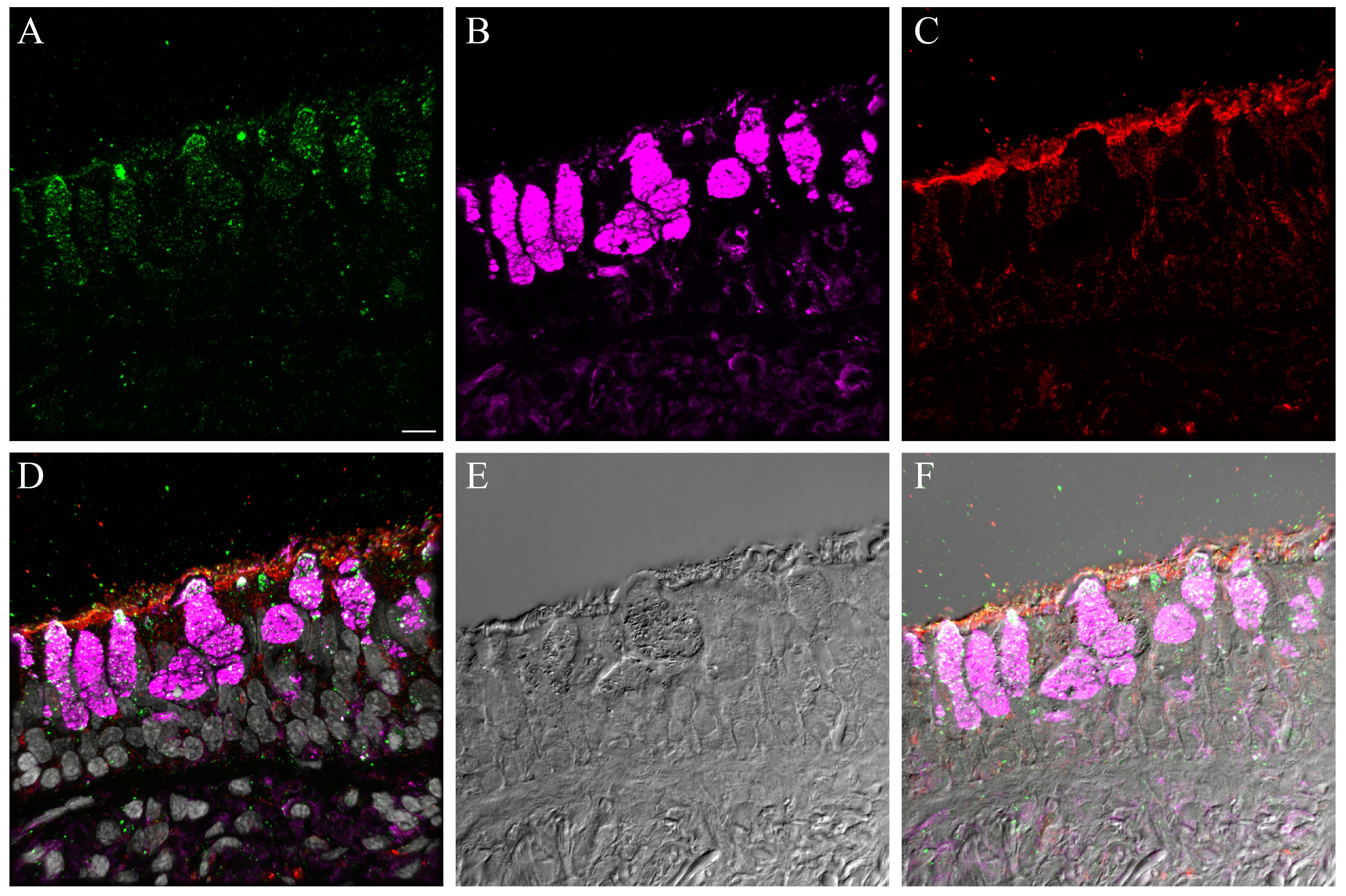 graphic file with name S18_dt_NY312_AF594_cell_markers.jpg