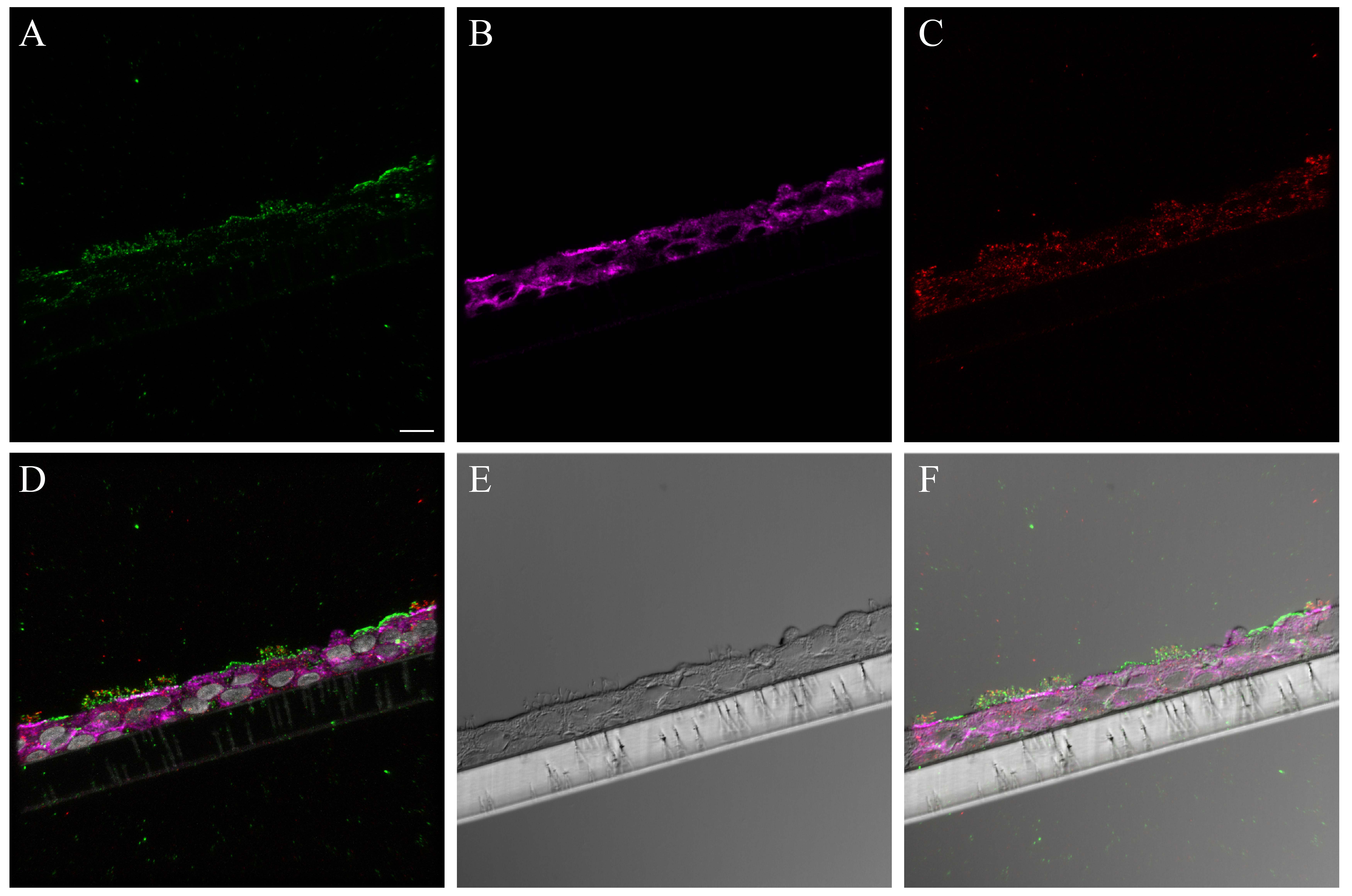 graphic file with name S17_NHBE_NY312_AF594_cell_markers.jpg