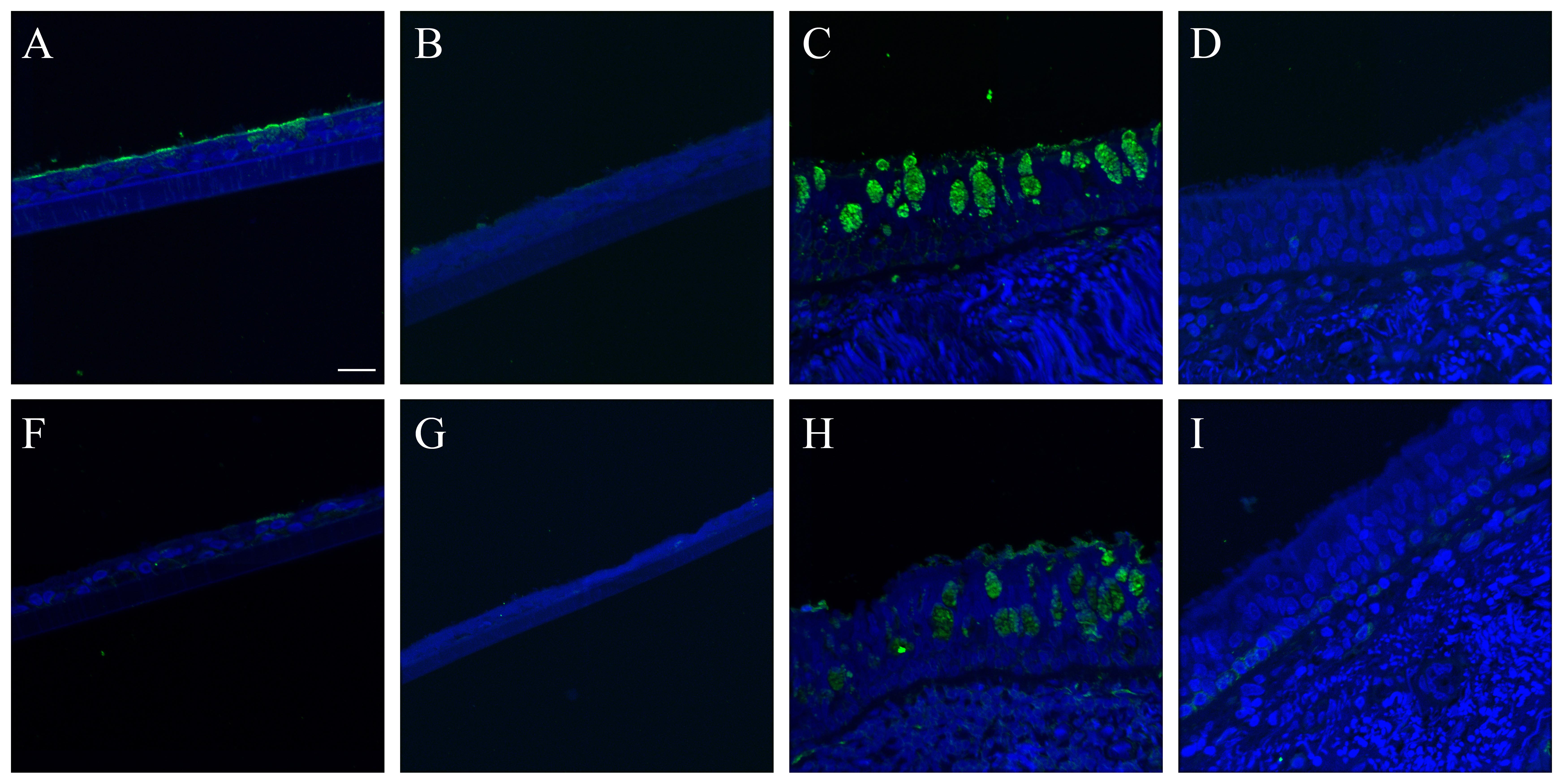 graphic file with name S7_r_lectins_with_NA_tx_ctl.jpg