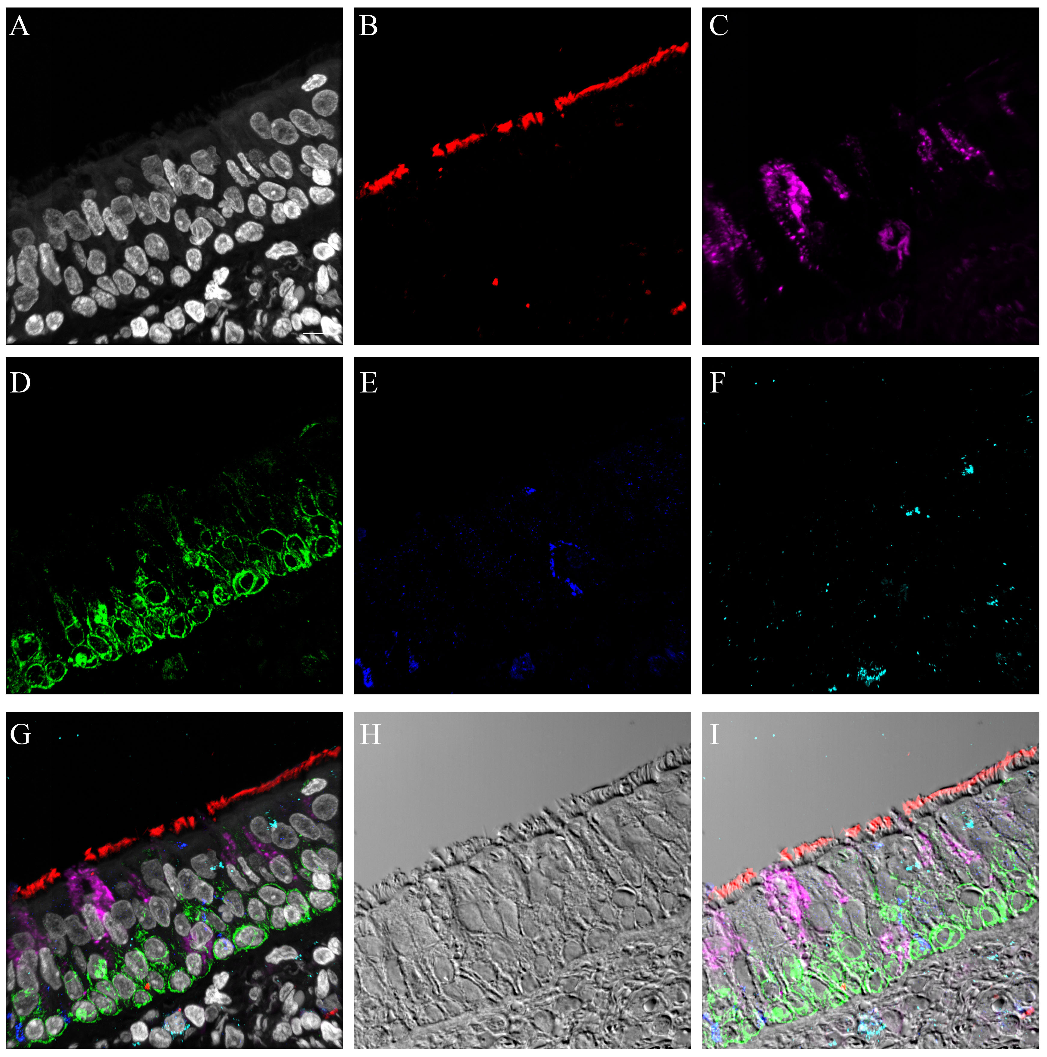 graphic file with name S4_distal_trachea_2_cell_markers.jpg