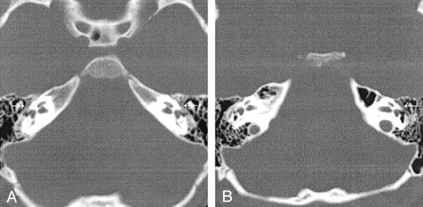 Fig 3.