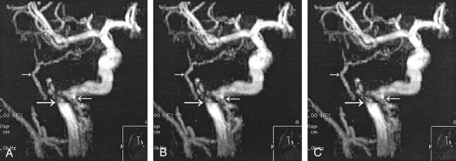 Fig 6.