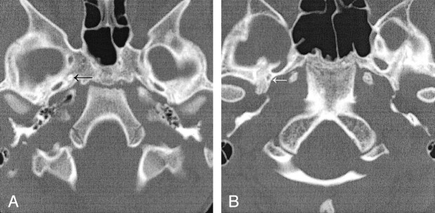 Fig 2.