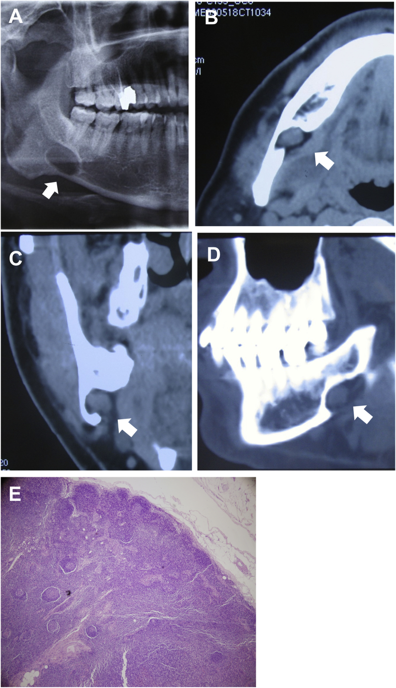 Figure 1