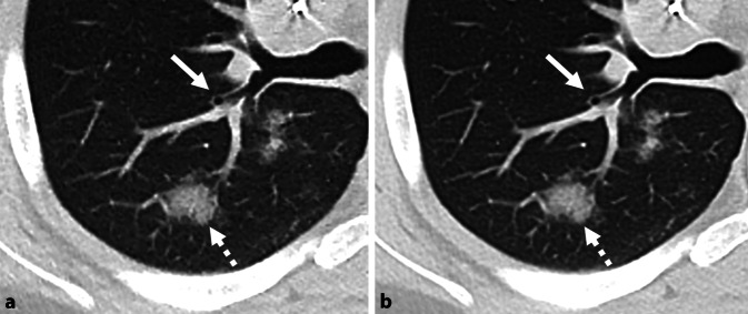 graphic file with name 112_2021_1230_Fig3_HTML.jpg