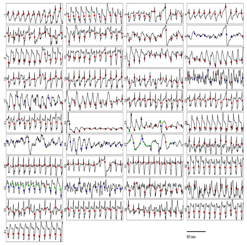 Fig. 12