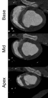 Figure 2a: