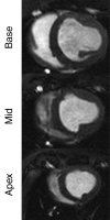 Figure 1a: