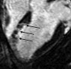 Figure 5d: