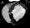 Figure 5a: