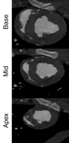 Figure 2b: