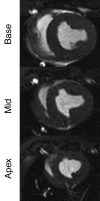 Figure 1b: