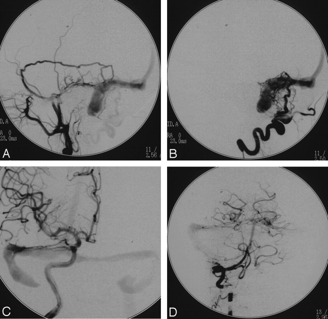 Fig 3.