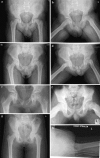 Fig. 1