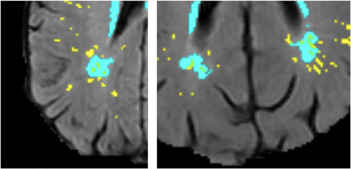 Figure 11