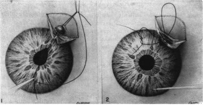 FIGURE 1, 2