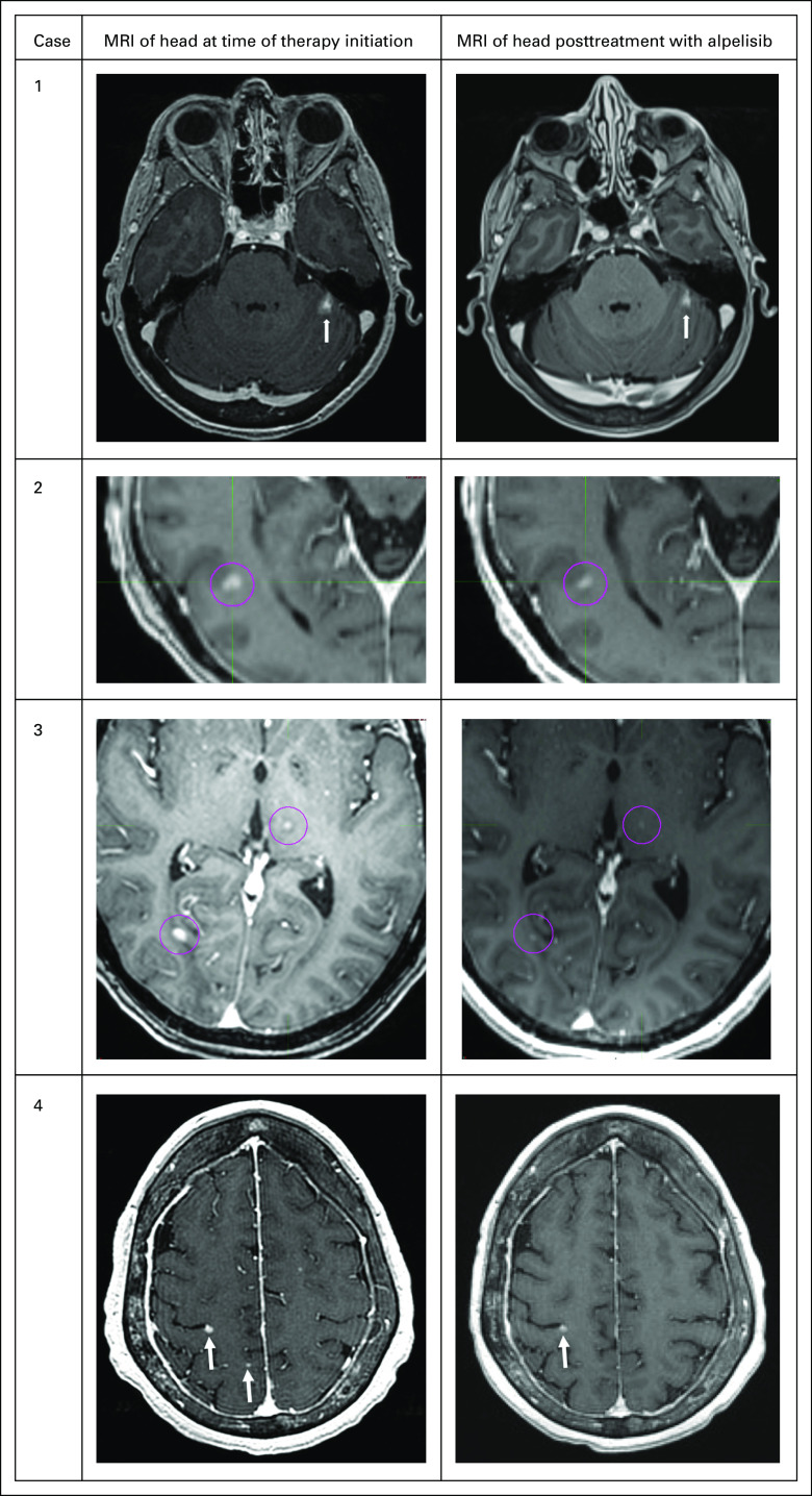 FIG 1.