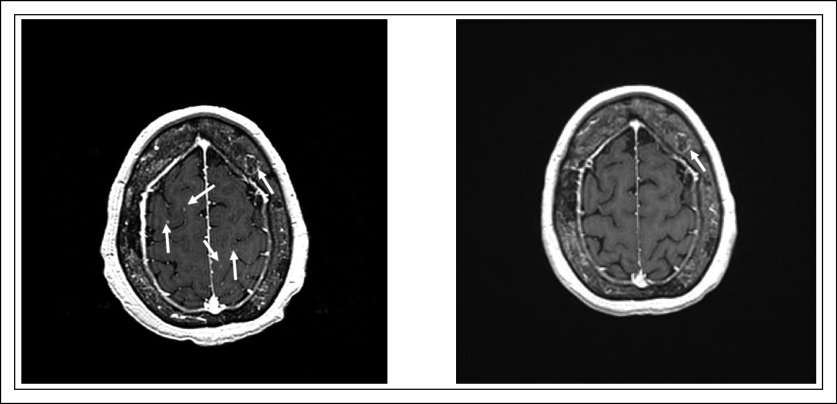 FIG. A1.