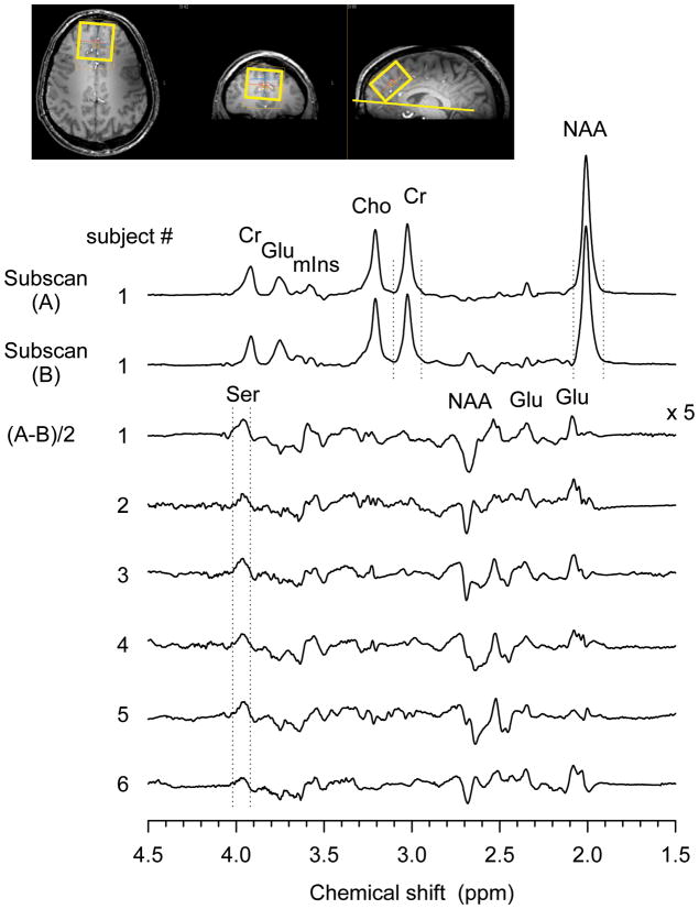 FIG 4