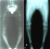 Fig. 3A–B