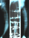 Fig. 4A–C